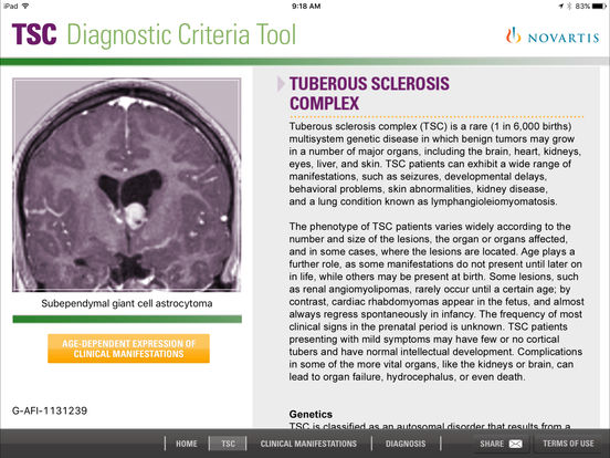 TSC Diagnostic Tool