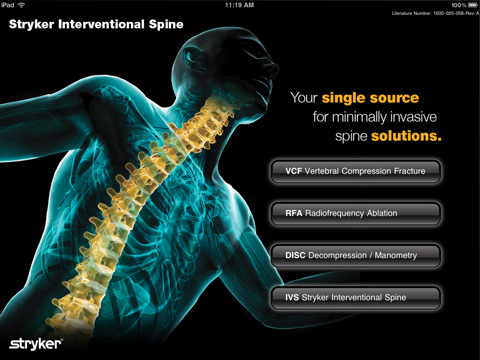 Stryker IVS for iPad