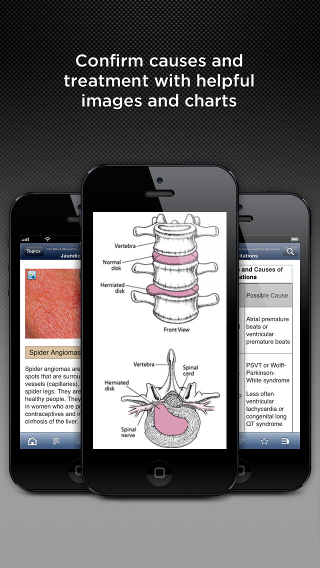 The Merck Manual Home Symptom Guide for iPhone