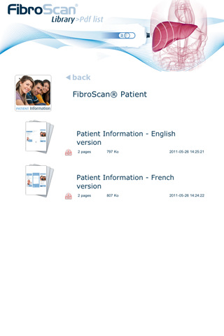 FibroScan for iPhone