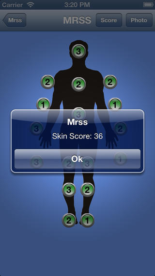 Modified Rodnan Skin Score for iPhone