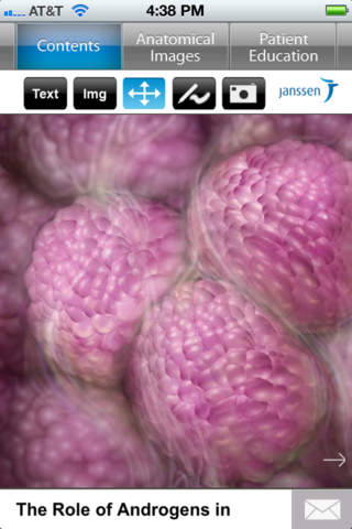 Understanding Prostate Cancer for iPhone