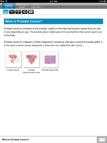 Understanding Prostate Cancer for iPad