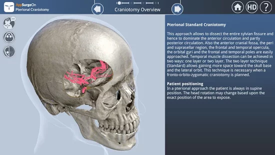 Pterional Craniotomy