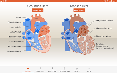 Herzstark in 3D