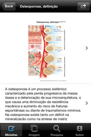 Atlas Osteoporose for iPhone