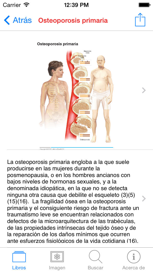 Osteoporosis for iPhone