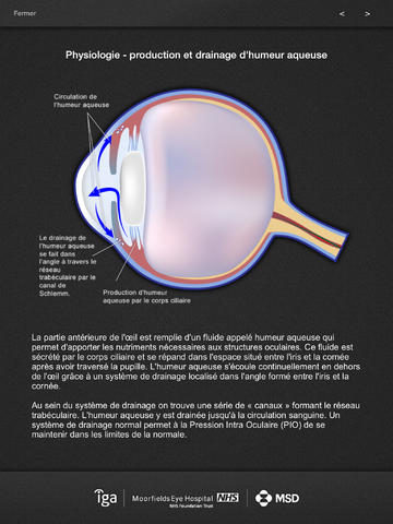 Glaucome Info for iPad