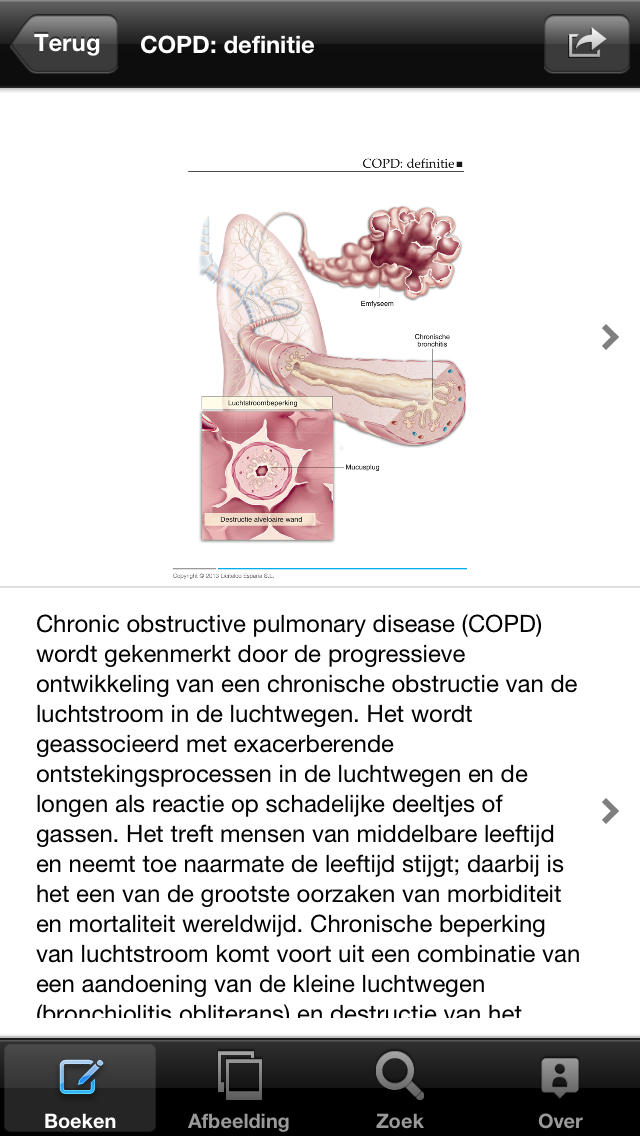 Miniatlas COPD for iPhone