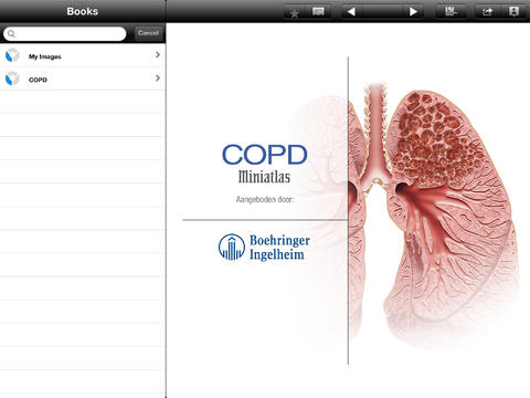 Miniatlas COPD for iPad