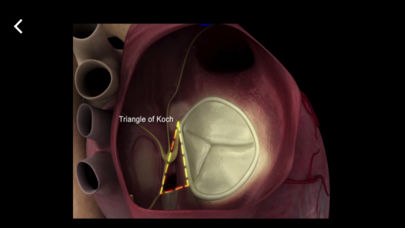 HEART MASTER Mitral & Tricuspid Valves for iPhone