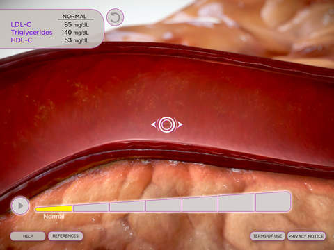 Lipids and You for iPad