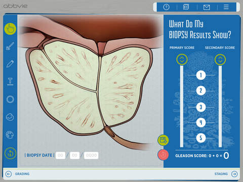 Prostate Cancer Counselor for iPad