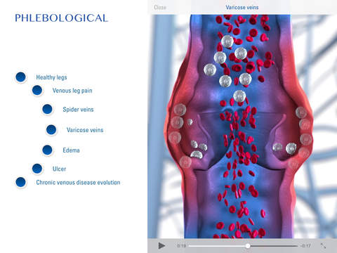 Phlebological for iPad