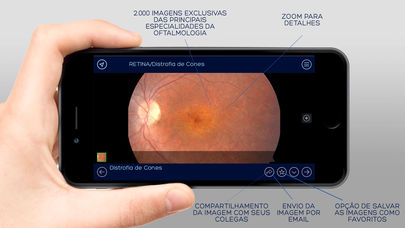 Banco de Imagens Oftalmologia for iPhone