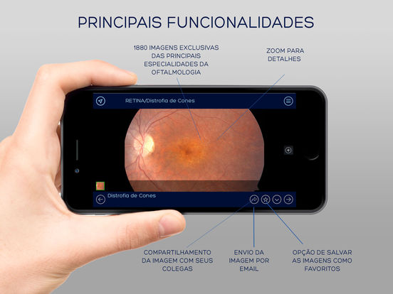Banco de Imagens Oftalmologia for iPad