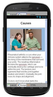 Rheumatoid Arthritis Disease