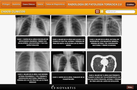 Radiología Patología Torácica
