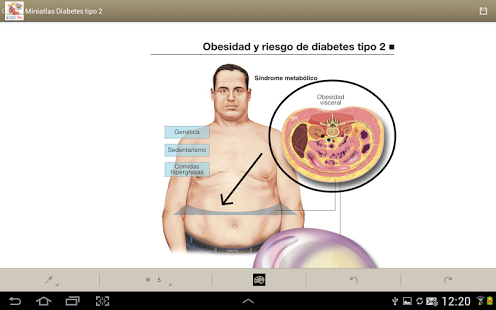 Miniatlas Diabetes tipo 2