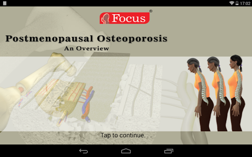 Postmenopausal Osteoporosis