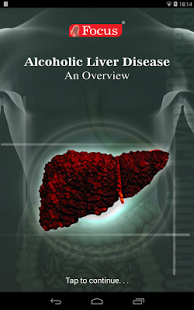 Alcoholic Liver Disease (ALD)