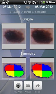 Doctor Mole - Skin cancer app