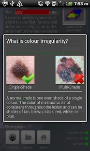 Doctor Mole - Skin cancer app