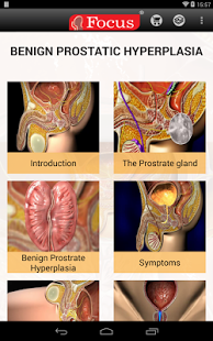 Benign Prostatic Hyperplasia