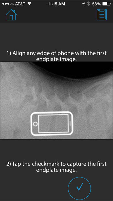 SAGI(SM) Clinical Solutions Lordosis Measurement Application for iPhone