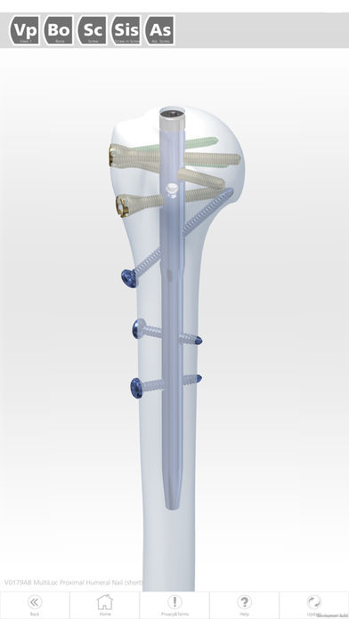 DePuy Synthes eModels for iPhone